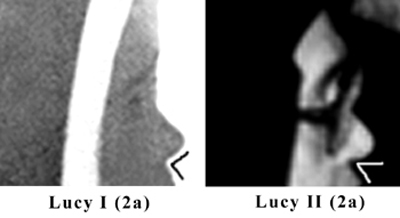 profile differences between the two sister Lucy's